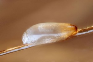 head-lice-egg