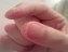 ۱۵ درمان خانگی نوک انگشتان پوسته پوسته