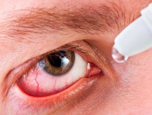 دانستنی هایی کامل درباره خشکی چشم
