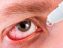 دانستنی هایی کامل درباره خشکی چشم