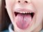 راهکارهایی برای درمان سوختگی زبان و گلو