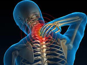 با علل و درمان آرتروز گردن آشنا شوید..!